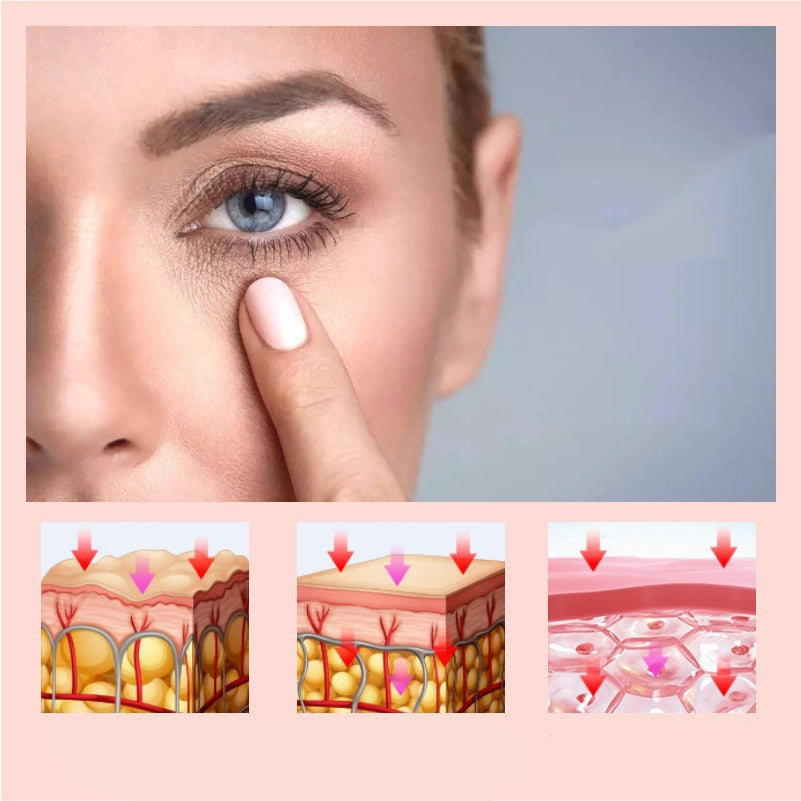 4-in1 Photon Therapy Eye Massager - EssentialEssentials1