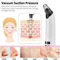 Electric Pore Vacuum - EssentialEssentials1