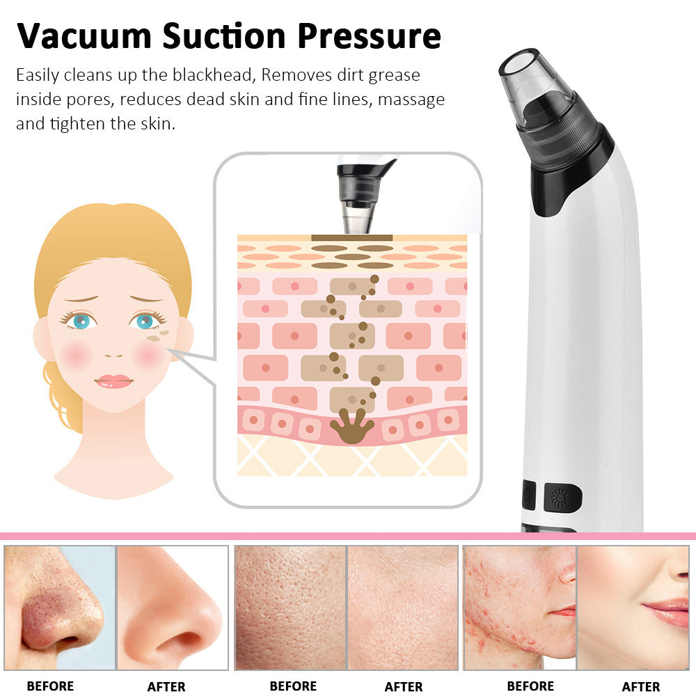 Electric Pore Vacuum - EssentialEssentials1