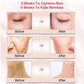 Face Lifting Skin Care - EssentialEssentials1