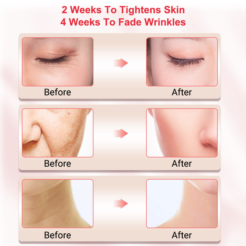 Face Lifting Skin Care - EssentialEssentials1